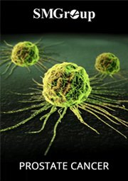 Prostate Cancer cover