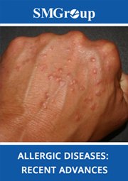 Allergic Diseases cover