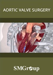 Aortic Valve Surgery cover