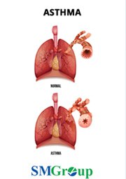 Asthma cover