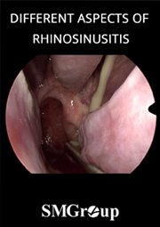 Different Aspects Rhinosinusitis cover